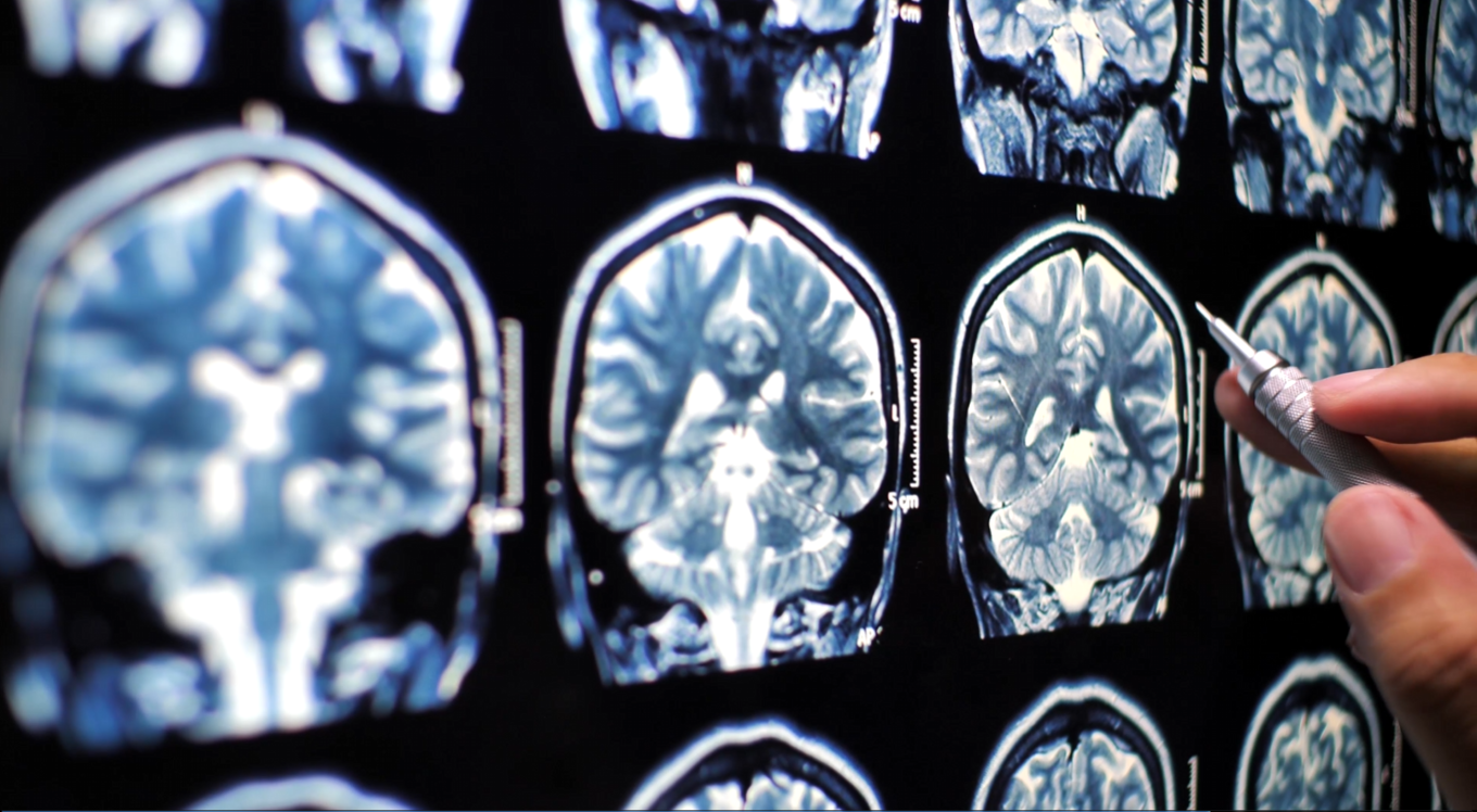 Studying x-rays of human brain